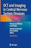 OCT and Imaging in Central Nervous System Diseases: The Eye as a Window to the Brain