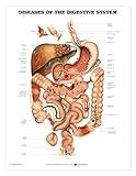 Diseases of The Digestive System Anatomical Chart