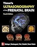 Timor's Ultrasonography of the Prenatal Brain, Fourth Edition