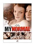 My Normal