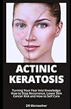 ACTINIC KERATOSIS: Turning Your Fear Into Knowledge: How to Stop Recurrence, Lower Skin Cancer Risk and How to Self Care (DISEASES AND CONDITIONS: A TO Z)