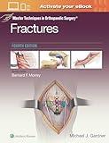 Master Techniques in Orthopaedic Surgery: Fractures