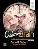 Osborn's Brain