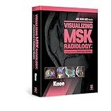 Visualizing MSK Radiology: A Practical Guide to Radiology Mastery