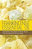 Frankincense Essential Oil: Everything You Need To Know About The Essential Oil Fit For Kings (The Essential Oils Uncovered)