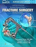 Harborview Illustrated Tips and Tricks in Fracture Surgery