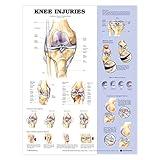Knee Injuries Anatomical Chart