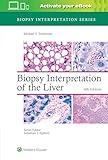 Biopsy Interpretation of the Liver (Biopsy Interpretation Series)