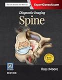 Diagnostic Imaging: Spine