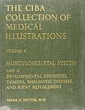 Musculoskeletal System: Developmental Disorders, Tumors, Rheumatic Diseases, and Joint Replacement (Netter Collection of Medical Illustrations, Volume 8, Part 2)