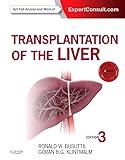 Transplantation of the Liver