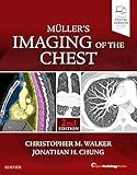 Muller's Imaging of the Chest: Expert Radiology Series