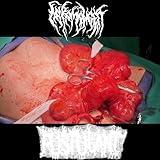 Really Long Medical Word for an Obscure Disease That Most Doctors Wouldn't Recognize [Explicit]