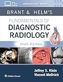 Brant & Helms' Fundamentals of Diagnostic Radiology: Print + eBook with Multimedia