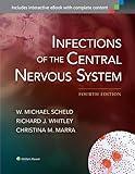 Infections of the Central Nervous System