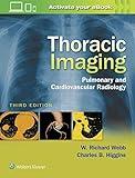 Thoracic Imaging: Pulmonary and Cardiovascular Radiology