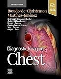 Diagnostic Imaging: Chest