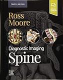 Diagnostic Imaging: Spine