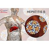 Hepatitis B Virus - Guidelines For Diagnosis And Treatment